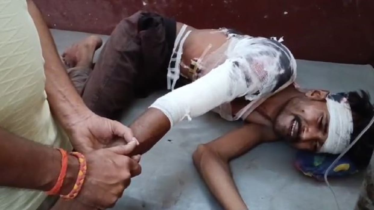 Tiger attacks father and son both seriously injured in lakhimpur kheri