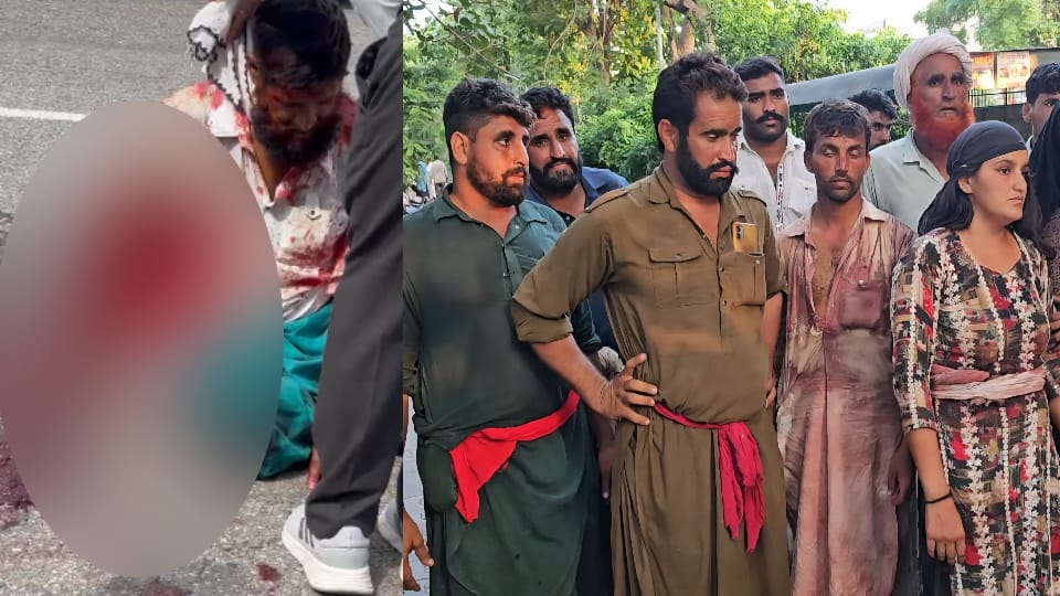 Man attacked with weapons and killed in Shambhu RG camp