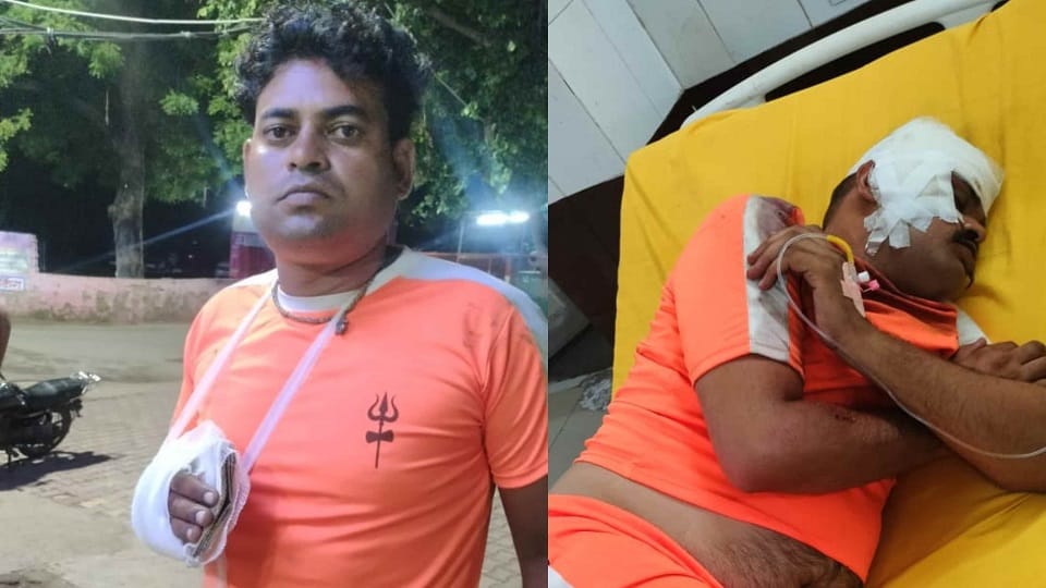 Dak Kanwad devotees injured after being hit by destitute animals