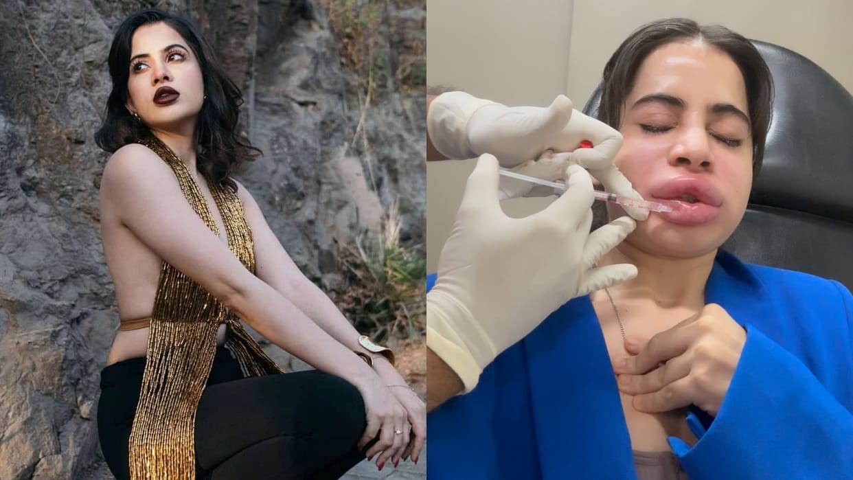 Uorfi javed shares video of lip filler removal treatment and she was in pain