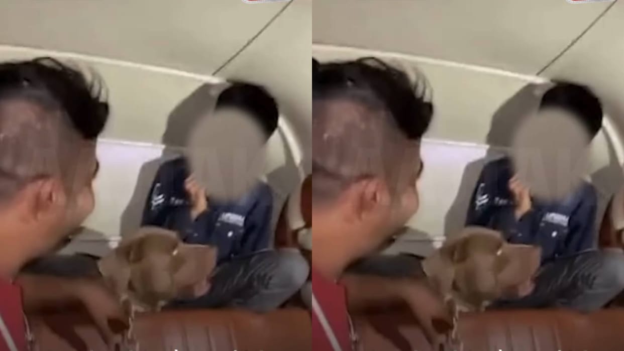 Pitbull mauls 11 year old child boy seriously injured and got several stitches video goes viral