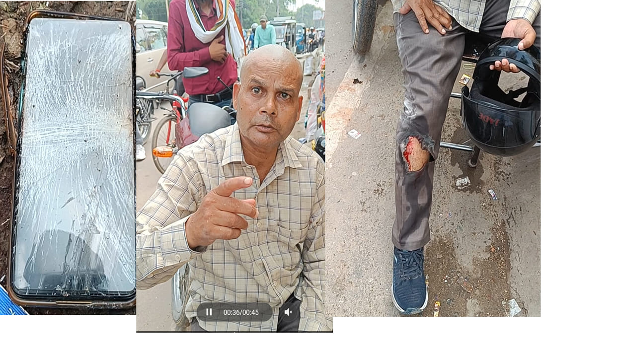 In Gorakhpur, Mobile phone exploded in pocket, health department employee injured