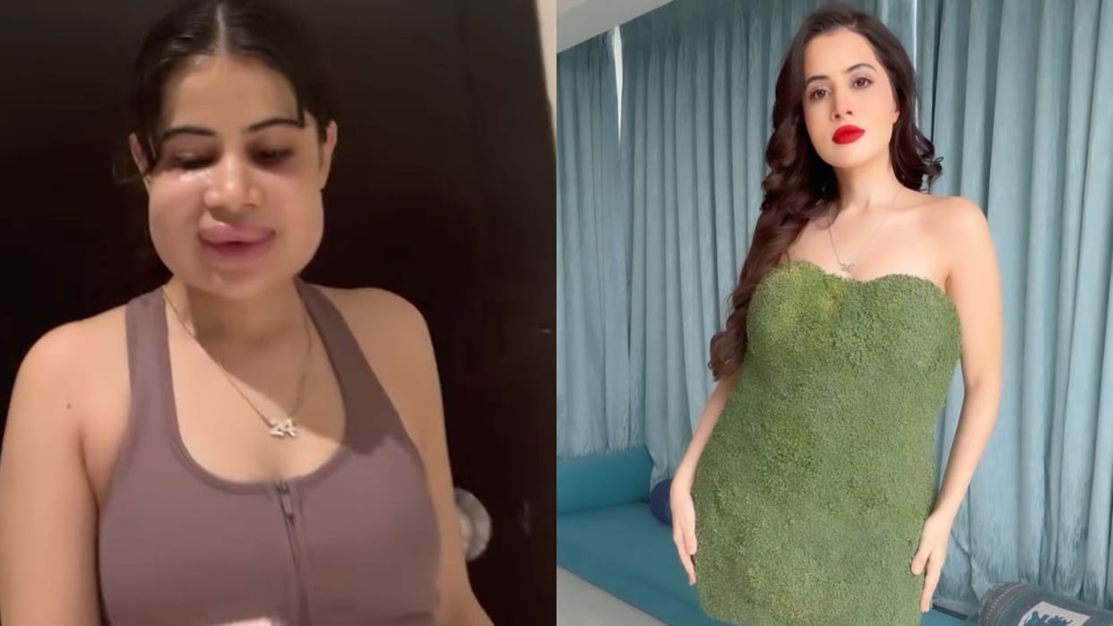 what is the reason behind uorfi javed lip swelling side effect of wrong lip fillers