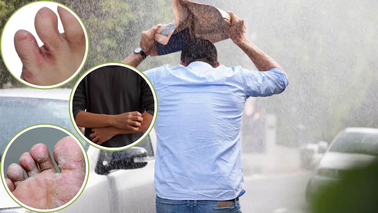 Monsoon Tips Take these precautions to avoid fungal infection during the rainy season