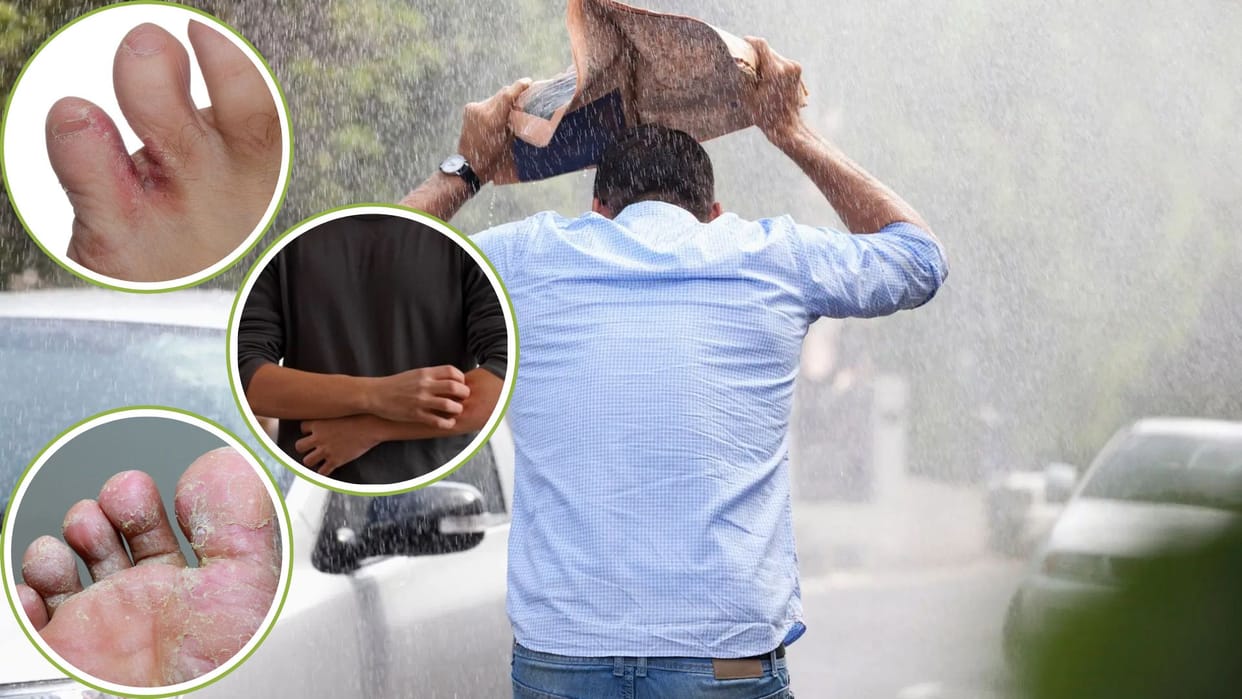 Monsoon Tips Take these precautions to avoid fungal infection during the rainy season