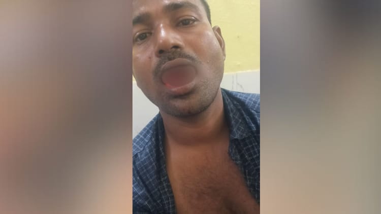 Bihar News: पति-पत्नी के झगड़े में पत्नी ने काट दी पति की जीभ, हालत नाजुक; गया जी का मामला