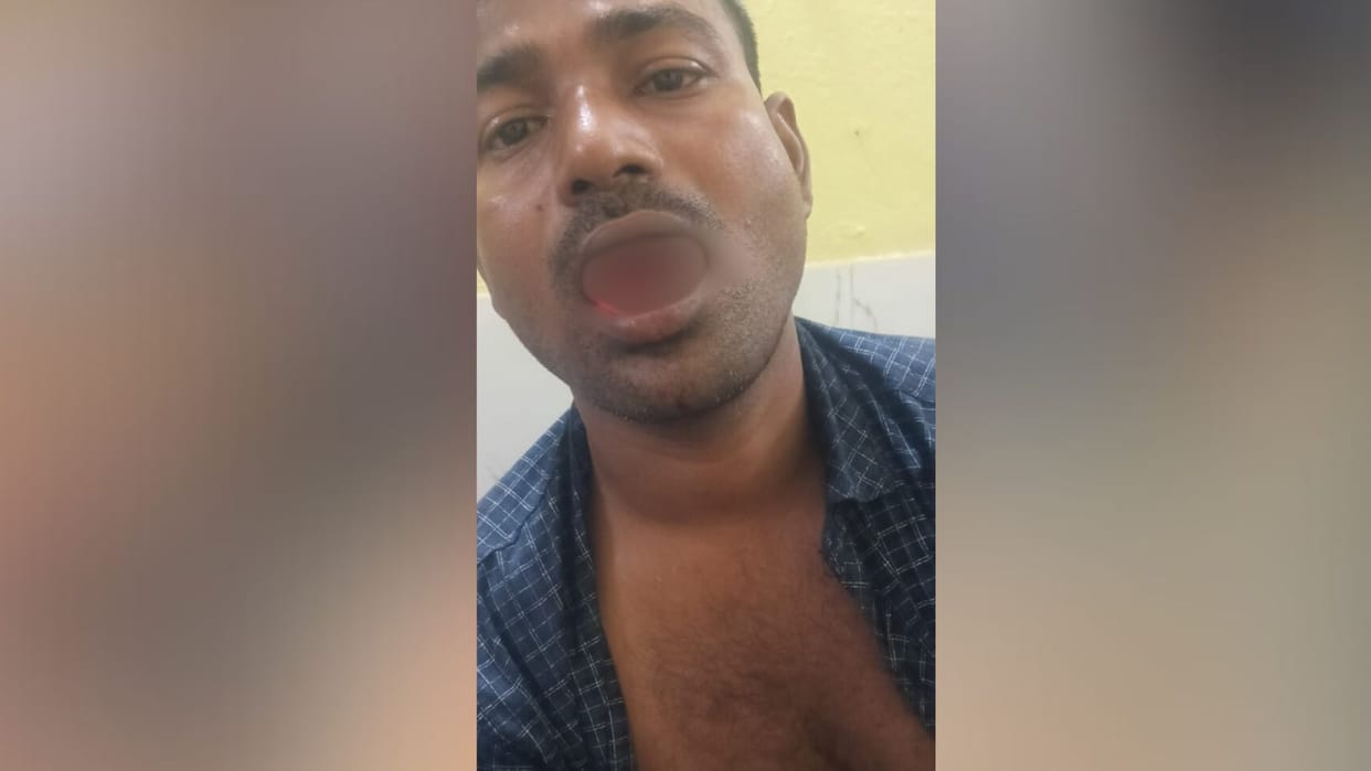 Bihar News: In a fight between husband and wife, the wife cut off the husband's tongue