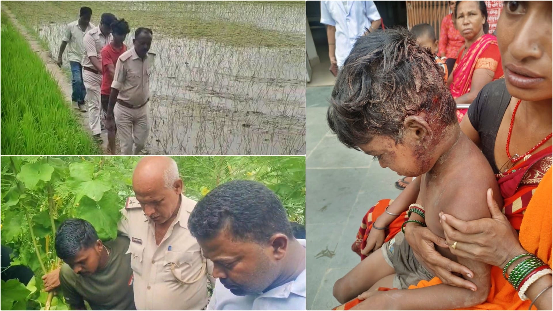 पुलिस ने घटनास्थल पर पहुंच शुरू की जांच, पीड़ित बच्चा