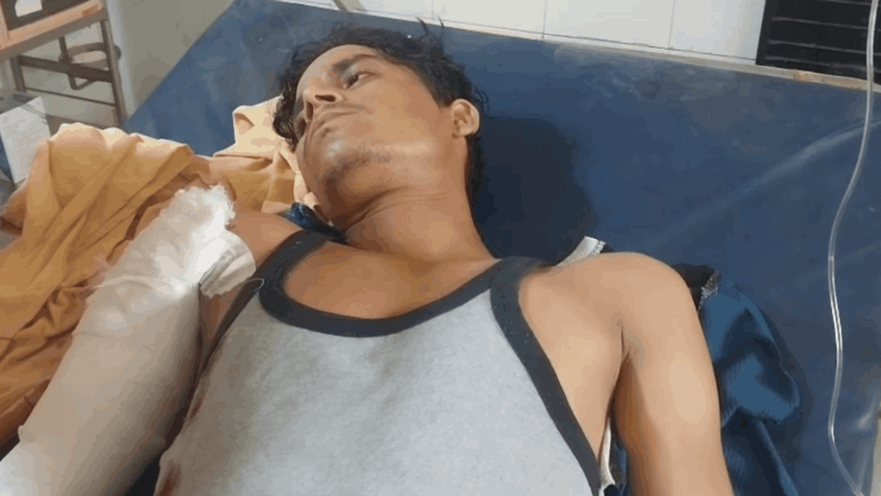 total of 15 cases of cutting by manjha reported in Palwal since July 10