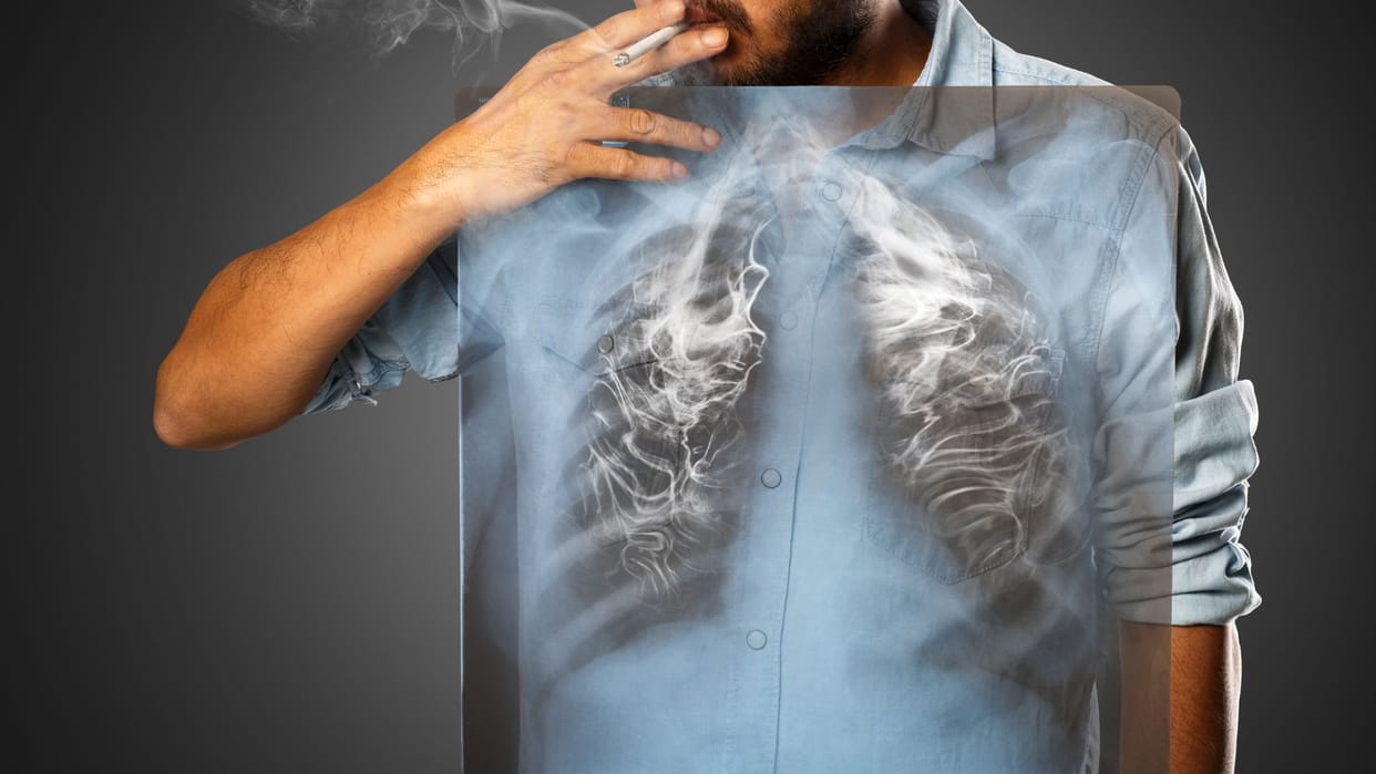 World Lung Cancer Day 2025 Stop Believing These Myths About Lung Cancer Know Facts