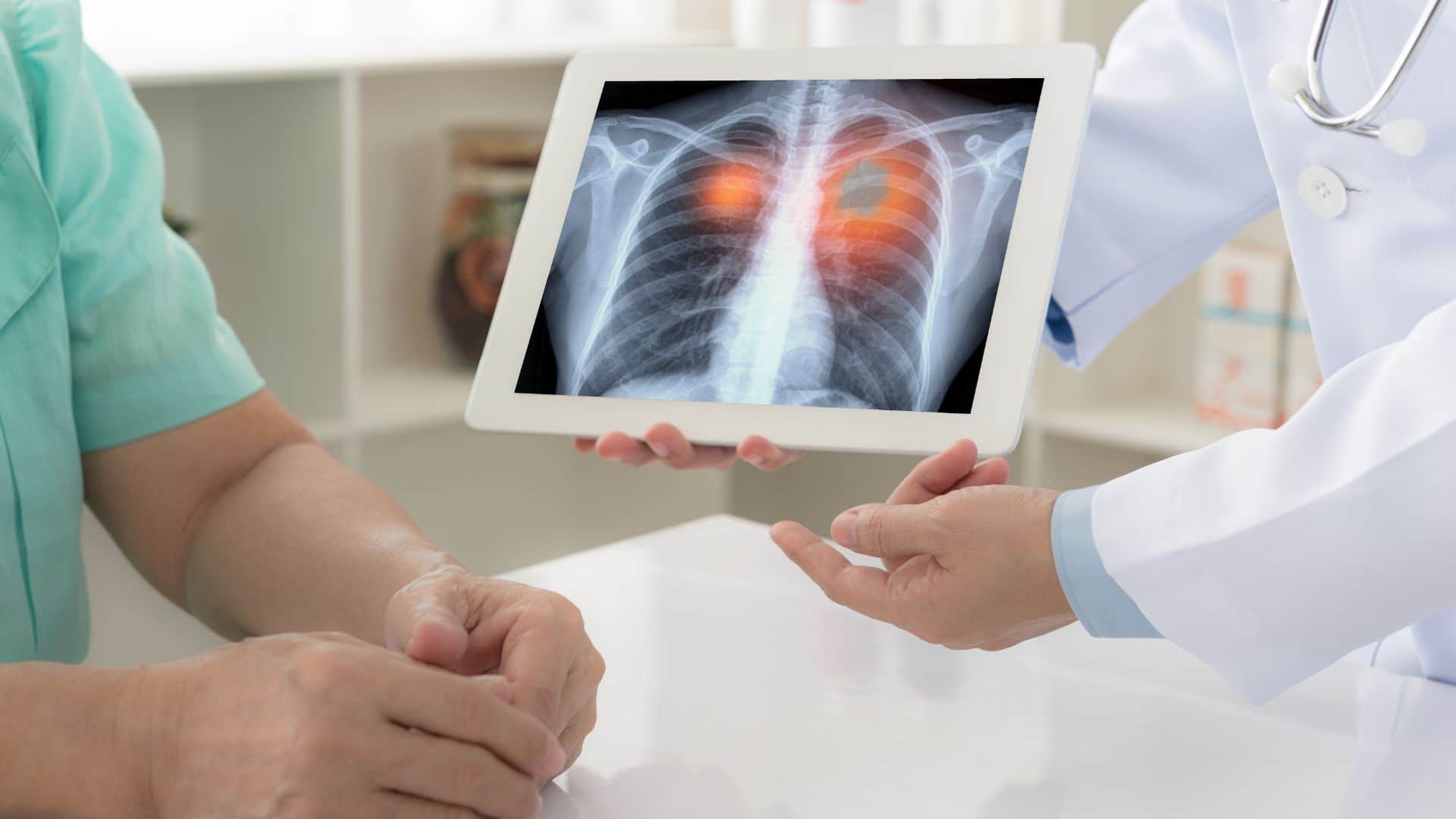 ICMR study shows lung cancer cases May Rise By 2030 in India