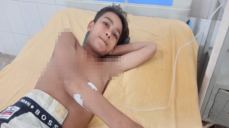 Moradabad: Heavy stone pelting in land dispute, madrasa student injured in firing