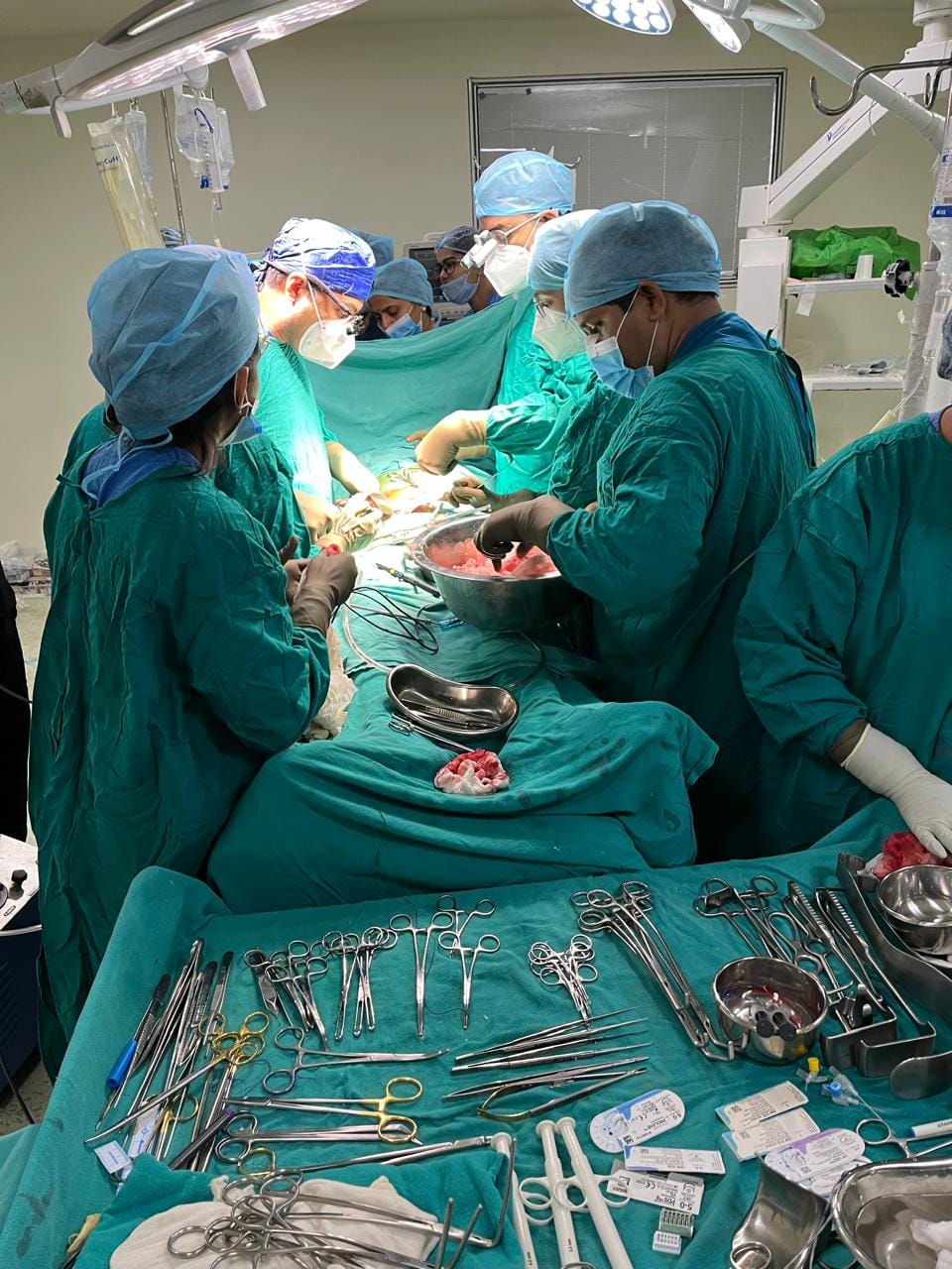 Bhopal: ABO-incompatible kidney transplant done for the first time in Hamidia, the first government hospital i