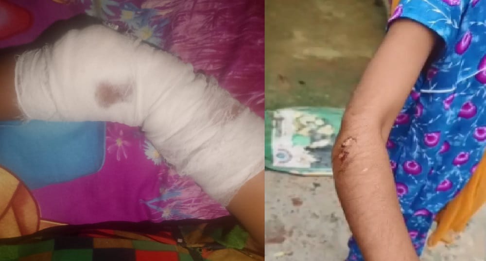 Kanpur Terror of biting monkeys half dozen injured in three days Pradhan said no action taken after complaint