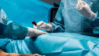 Half kg hairball removed from 10-yr-old girl's stomach in Amravati Maharashtra News In Hindi