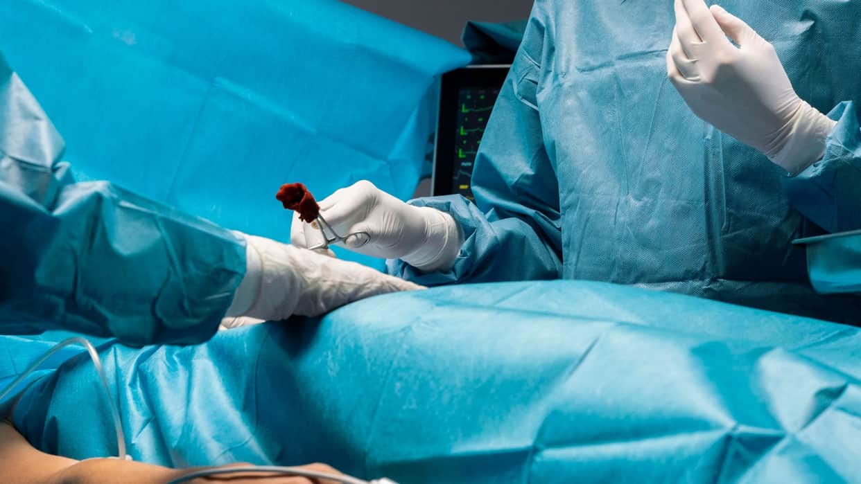Half kg hairball removed from 10-yr-old girl's stomach in Amravati Maharashtra News In Hindi