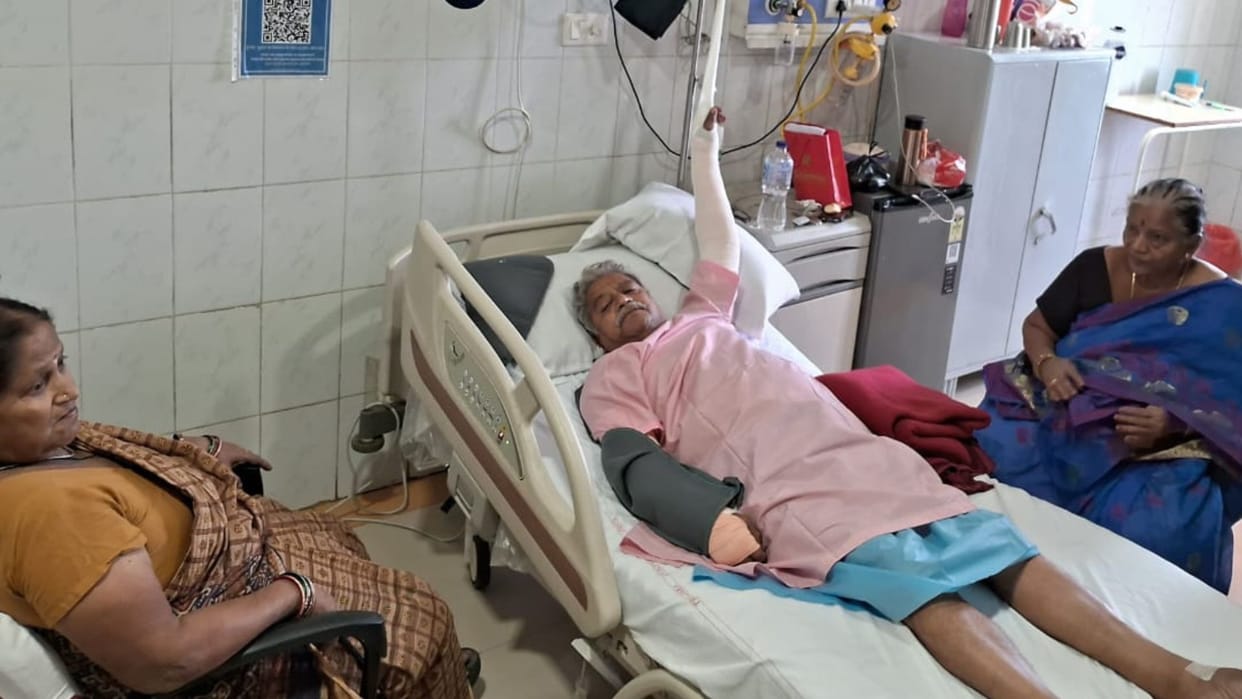 Varanasi News Overtook bike and parked it on road broke hand of BHU professor in varanasi