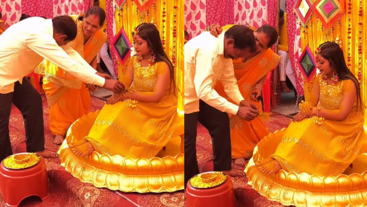 fathers tears welled up as he applied turmeric to his daughter everyones eyes got wet emotional video