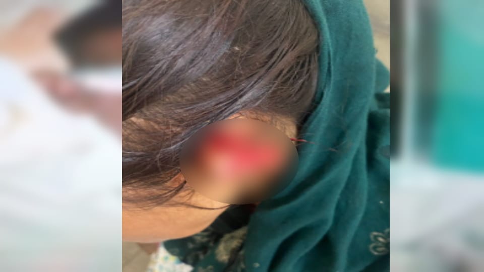 Brutal Clash in Meeruts Itaayra: Nephew Bites Off Aunt’s Ear, Injures 75-Year-Old Grandmother