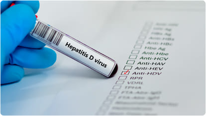 Lancet study says liver cancer may rise 55 percent by 2040 hepatitis and alcohol habits increasing risk