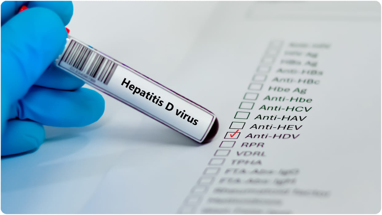 WHO declares Hepatitis D as carcinogenic know its causes and prevention tips in hindi
