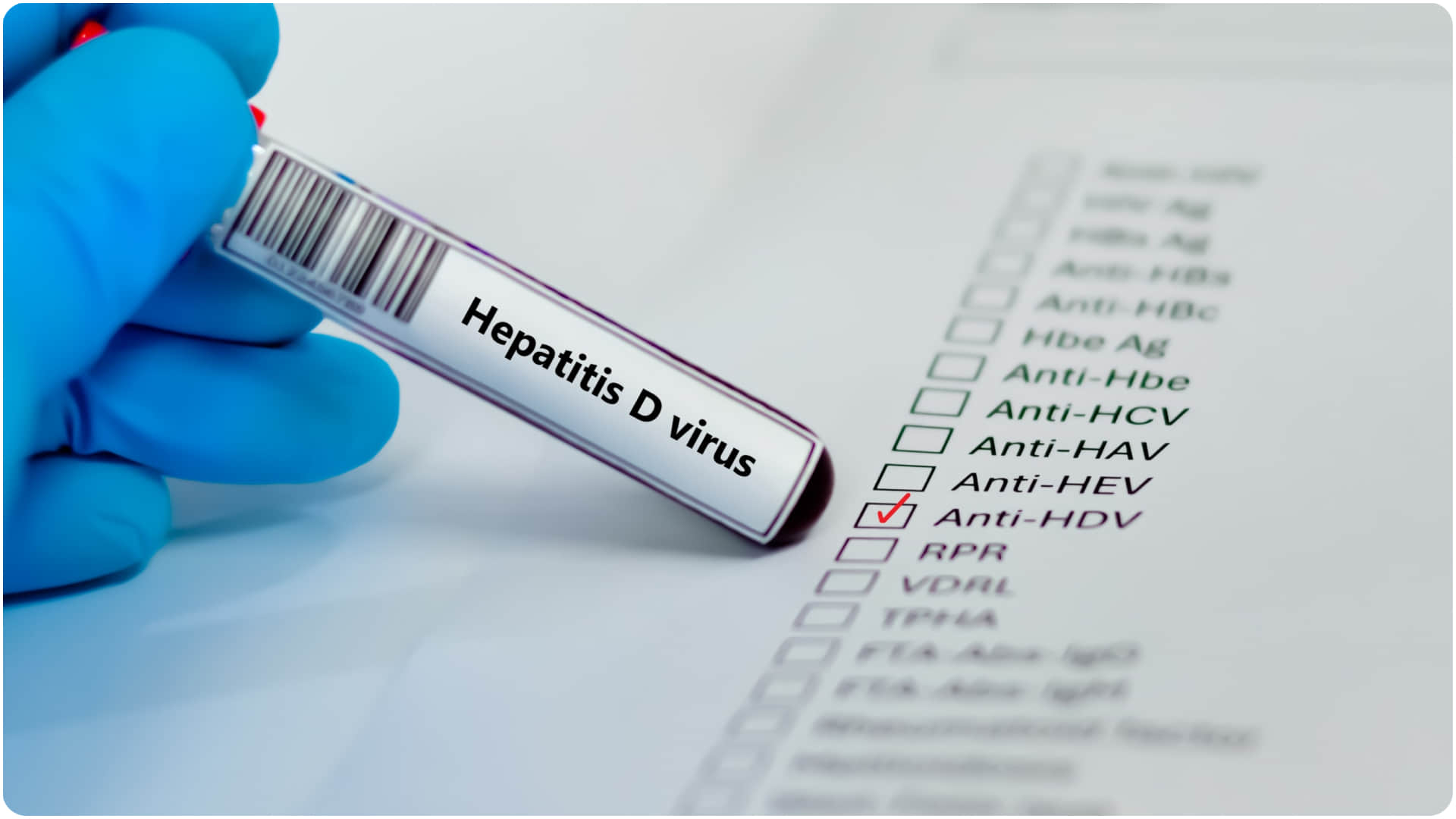 Hepatitis risk factors and when to go for test know hepatitis ke kya lakshan hai