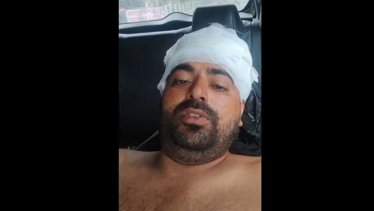 12 goons shot young man after fight In Loni area