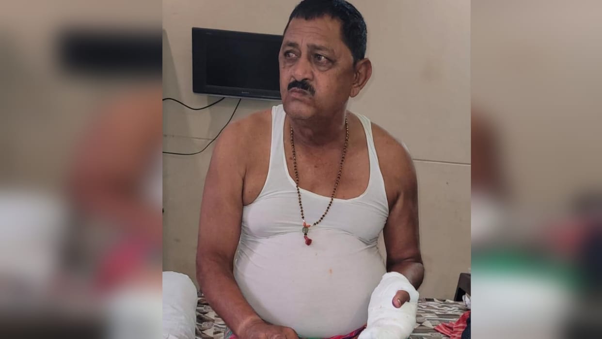 Prayagraj News: Former councilor who went out for morning walk was shot by bike riding miscreants