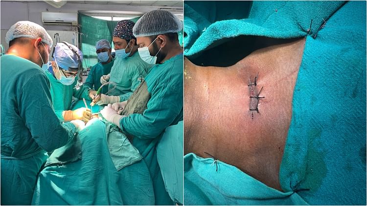 PMCH: सर्वाइकोथोरैसिक जंक्शन की एंटीरियर सर्वाइकल एप्रोच से सर्जरी सफल, राज्य के सबसे बड़े अस्पताल में हुआ ऐसा