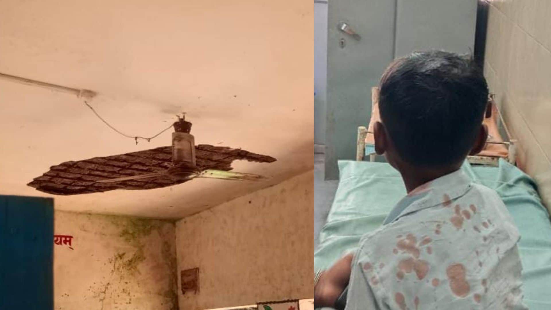 घायल बच्चा और छत का टूटा प्लास्टर