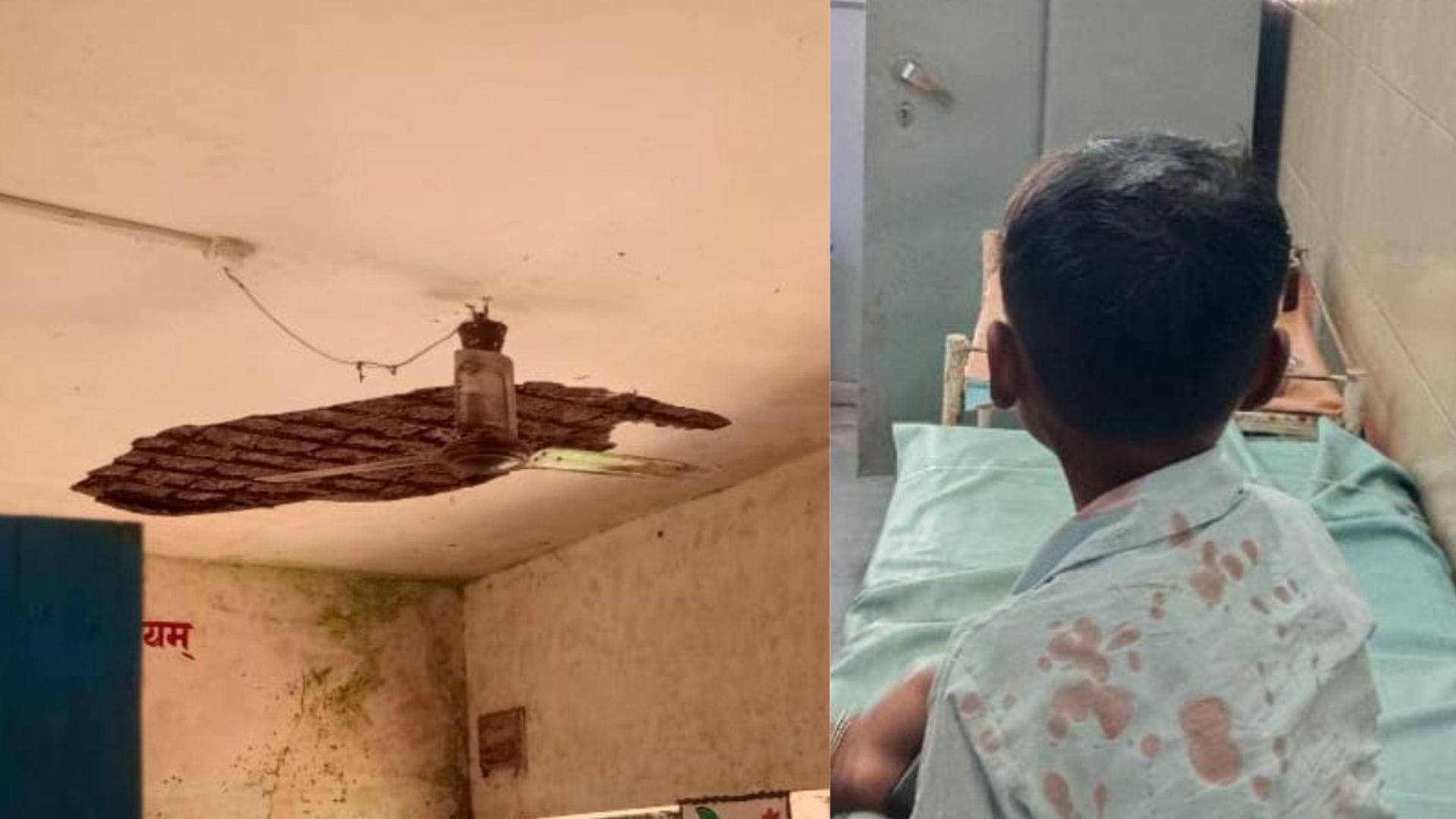 घायल बच्चा और छत का टूटा प्लास्टर