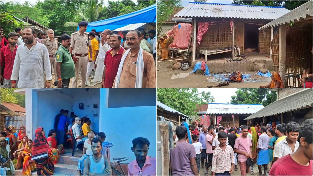 Katihar: Father and son burnt alive by sprinkling petrol; 12-year-old innocent dies, man's condition critical