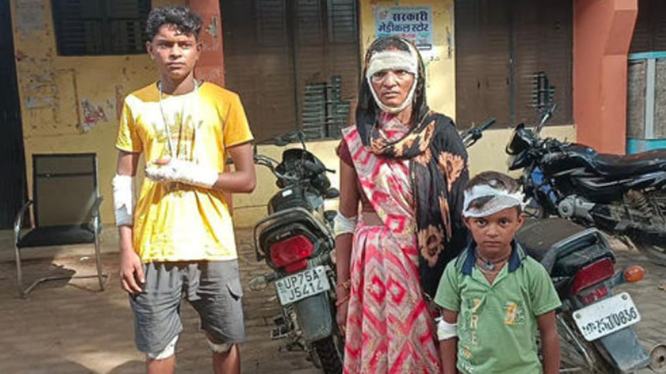 UP: Mother's love became a shield against the leopard and both sons were saved