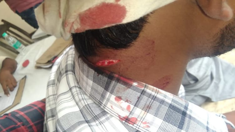 Bihar News: महागठबंधन प्रत्याशी पर जानलेवा हमला, बाल-बाल बचे; ड्राइवर गंभीर घायल, एक आरोपी गिरफ्तार