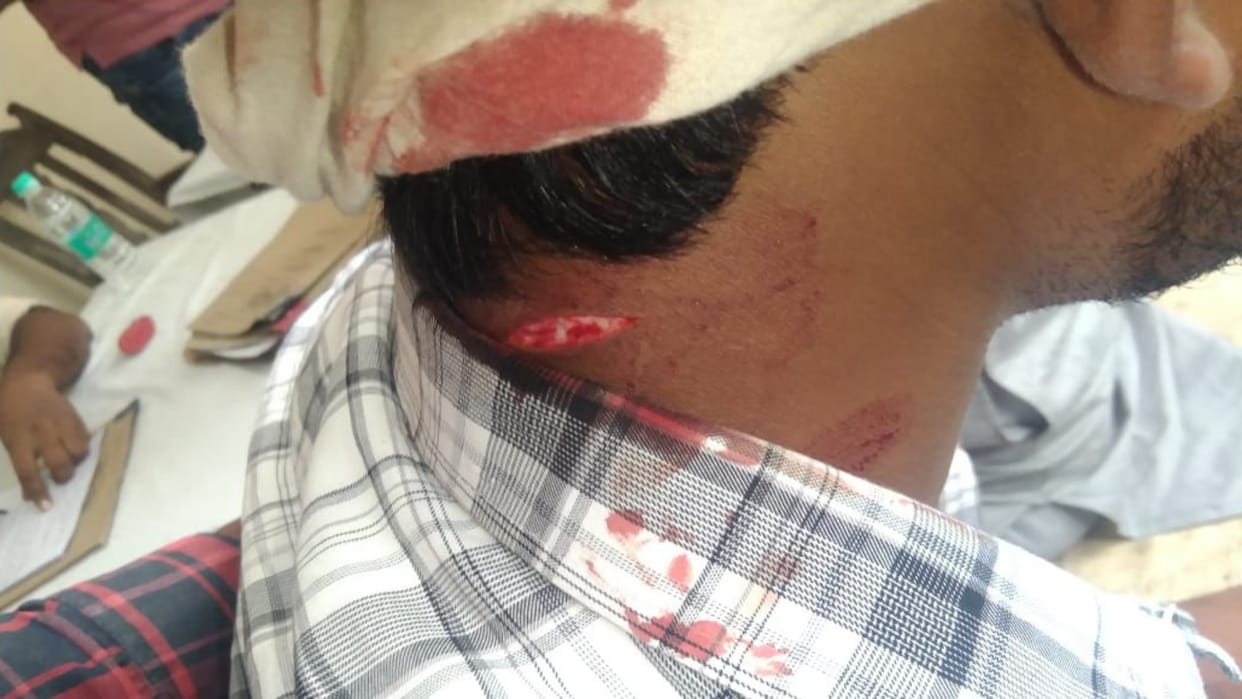 Muzaffarpur News: Mahagathbandhan Candidate Survives Murder Attempt, Driver Seriously Injured, One Arrested