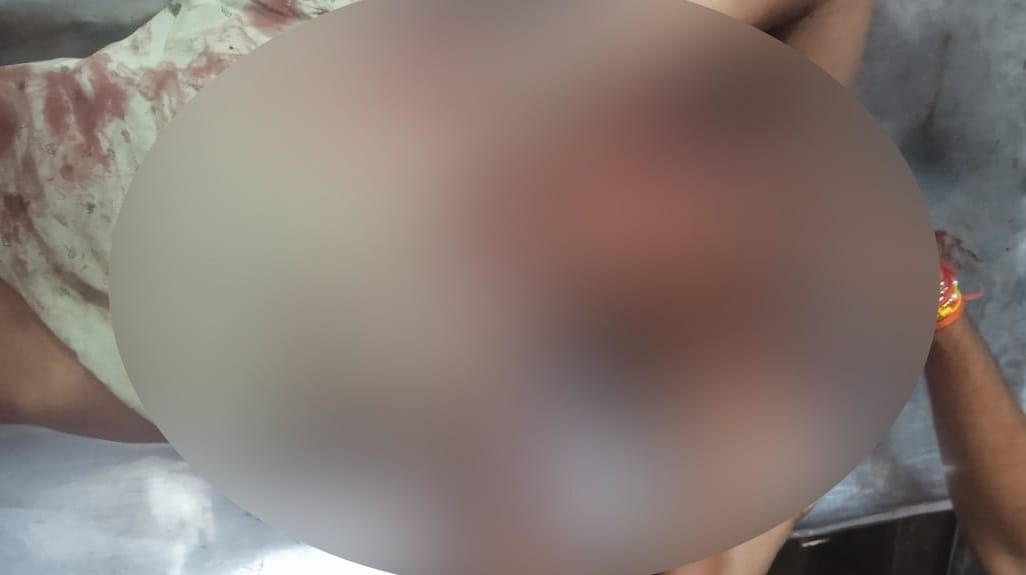 Farrukhabad Thieves broke into house youth was shot when he resisted family said police negligence