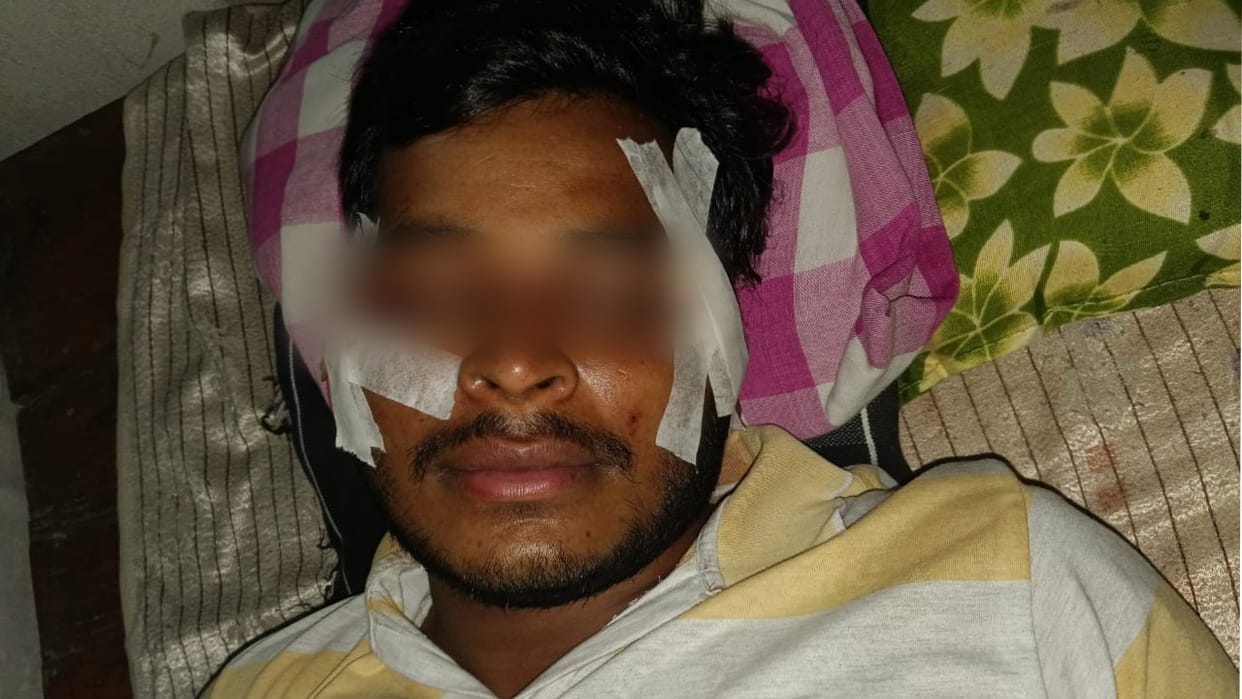 man injured after being hit by Chinese manjha on the Chaupula bridge in Bareilly