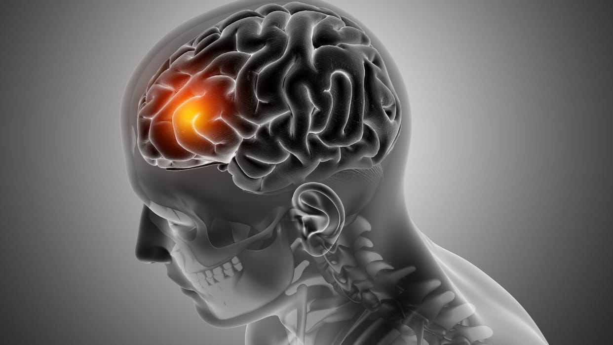 Neurological diseases are increasing rapidly in country, every third family is suffering from brain disease