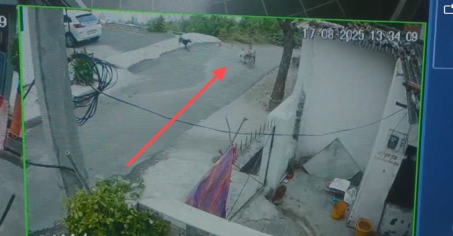 Rajasthan News Dog Bite Case In Udaipur Dogs attack again 5 year old innocent injured