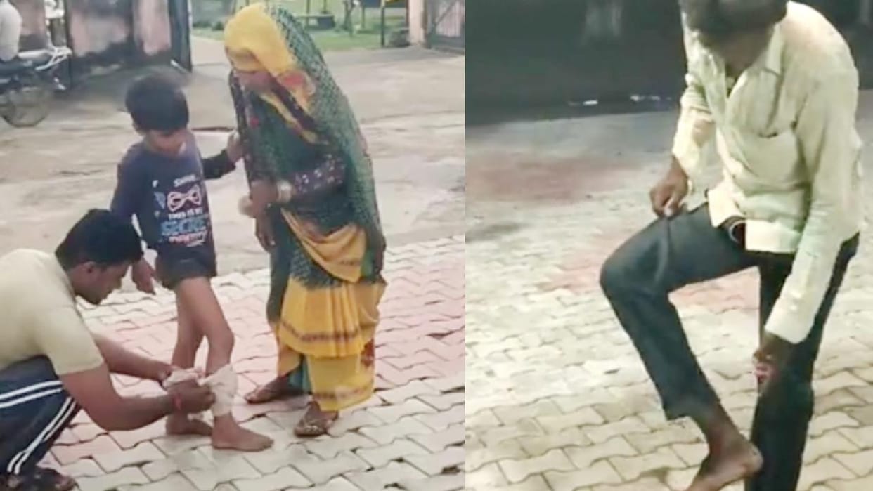Lalitpur: Stray dog creates fear in the village, injures three people including children