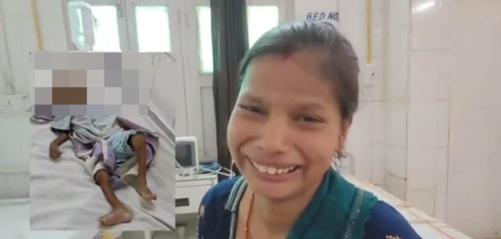 शिवपुरी में कुपोषण से बच्ची की हुई मौत।