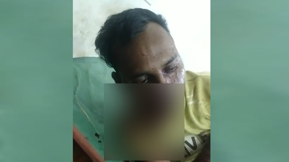 Mahoba: Youth shot in old rivalry, referred to Jhansi in critical condition