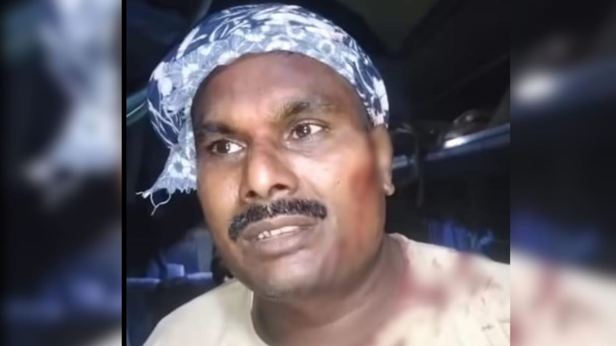 miscreants attack and broke head of bus driver with butt of gun in jaunpur prayagraj road