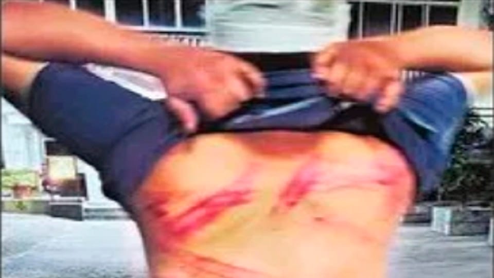 NCR: Guards beat husband with sticks during a quarrel between the couple, four arrested