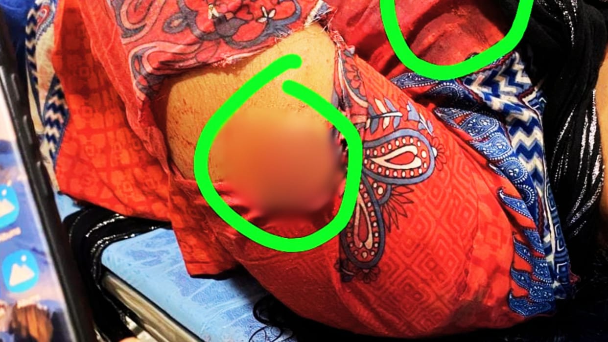 Woman clashed with five goons in chandauli fired and ran away condition critical daughter called police