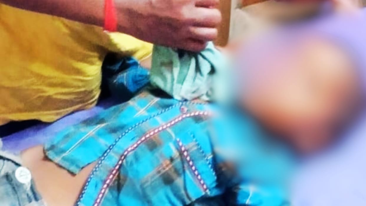 ferocious dog attacked an innocent ran away after biting his nose referred after first aid in bhadohi