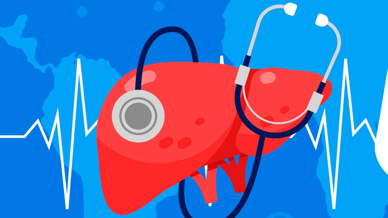 Couple dies after liver transplant surgery; notice issued to Pune hospital