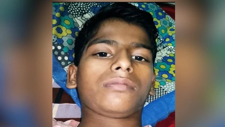 Muzaffarnagar: Class 9 student bitten by dog, died of rabies after two months, had not been injected