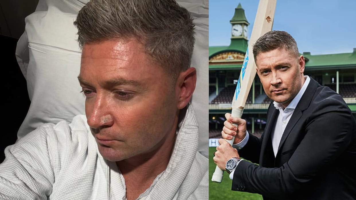 Michael Clarke undergoes sixth surgery for skin cancer posts on social media know details