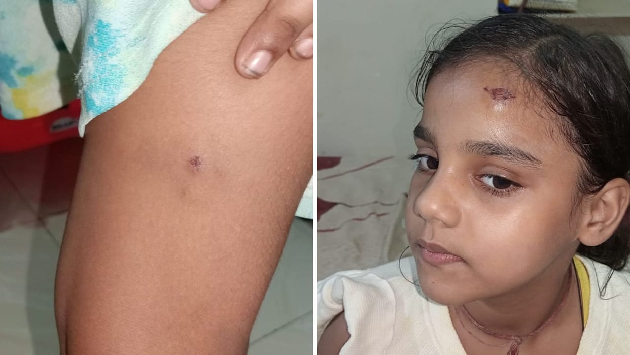 Dog Attack in varanasi Four dogs bite girls 200 meters away from Vishwanath Gate blood oozed out video viral